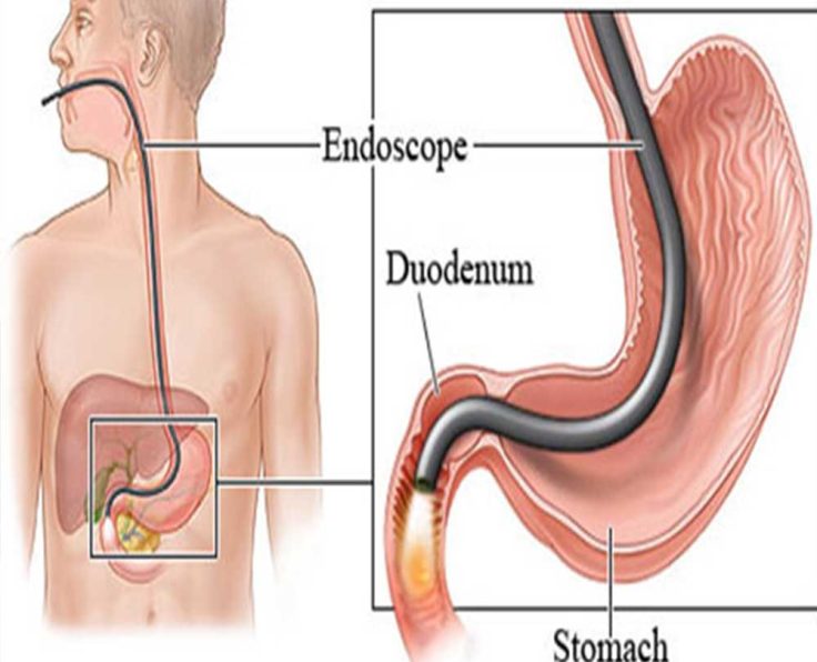 Diagnostic-and-Interventional-Endoscop